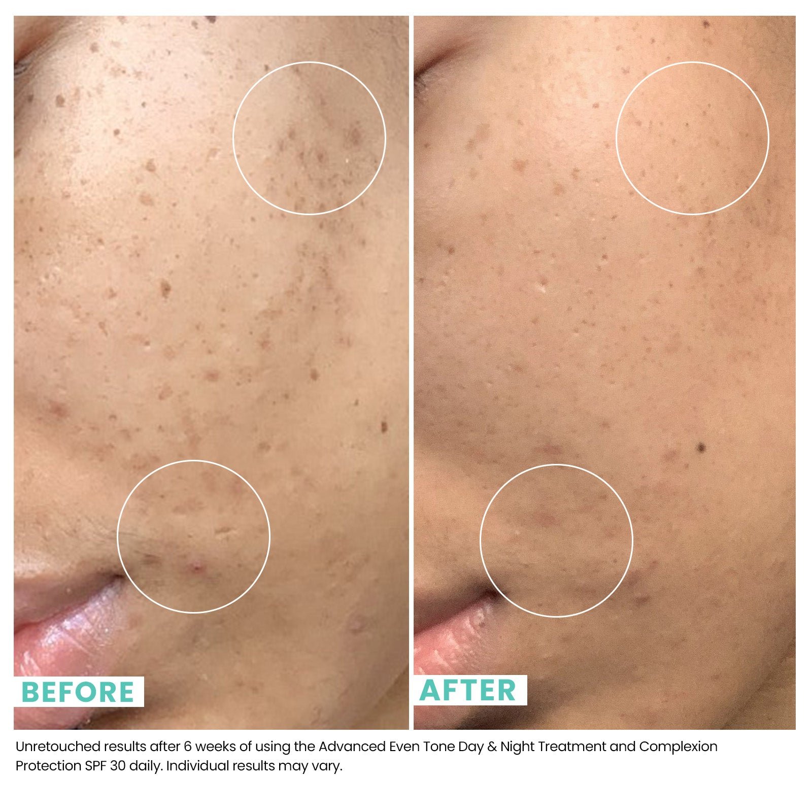 Comparison of woman's skin before and after using USRx even tone regimen